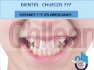 Frenillos dentales, tapaduras, implantes dentales, endodoncia
