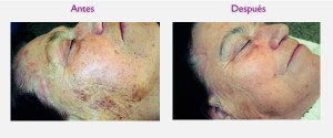Paulina Gonz&aacute;lez Anuncios gratis en Providencia |  PRECIOS TRATAMIENTOS REDUCTIVOS GARANTIZADOS, DEPILACI&Oacute;N LASER, anticelulitis, reafirmantes , faciales, drenaje linfatico, etc