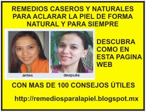 victor Anuncios gratis en  Manchas en la piel � aclarar la piel, Tratamiento para aclarar la piel, tratamiento para la cara, aclarar,