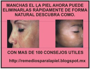 victor Anuncios gratis en  Aclarar piel � cremas para la cara, Tratamientos para la piel, como aclarar la piel naturalmente,