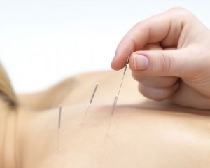 isabel Anuncios gratis en Providencia |  Acupuntura ,medicina china, flores de bach ,masaje ayurveda, Terapias complementarias ,stress, dolor articular